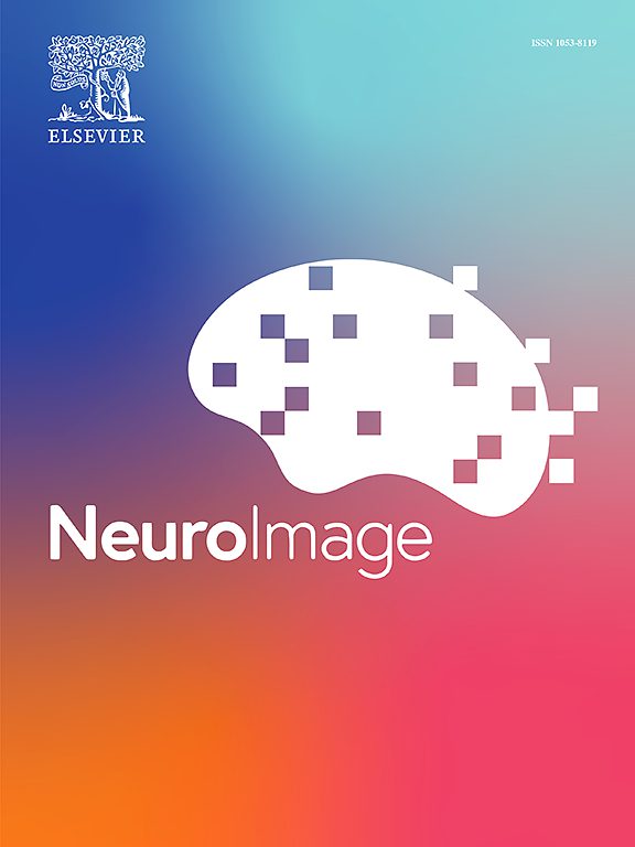 Nuevo paper en NeuroImage